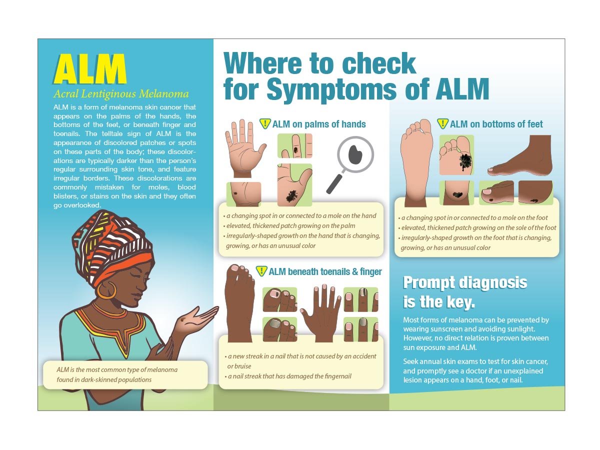 Illustration Design by ArtTank for University of utah | Design #21472799