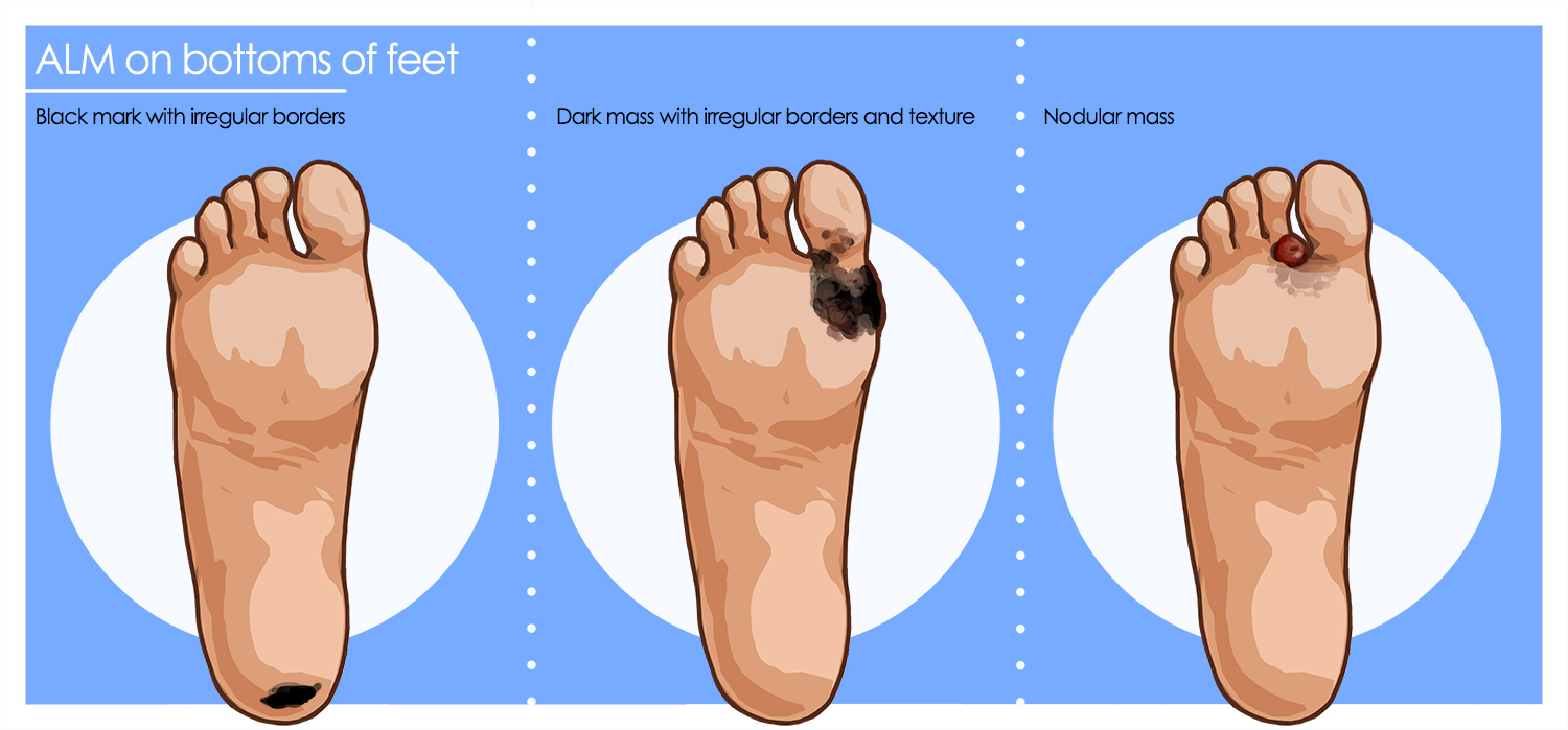 Illustration Design by smiledim24 for University of utah | Design #21424325