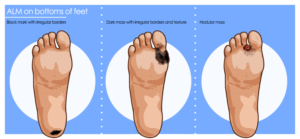 Illustration Design by smiledim24 for University of utah | Design: #21424325