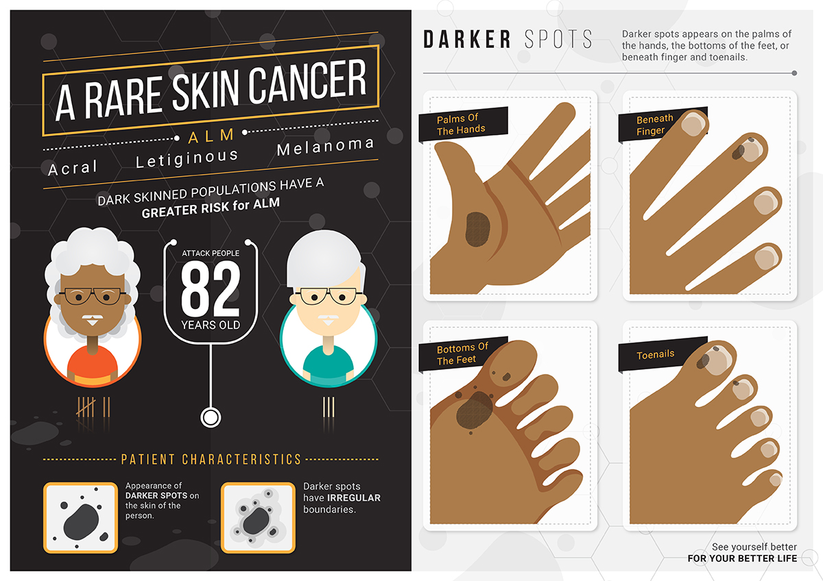 Illustration Design by Prabu Antasena for University of utah | Design #21476918