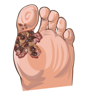 Illustration Design by vesna.radulovic1 for University of utah | Design: #21479853