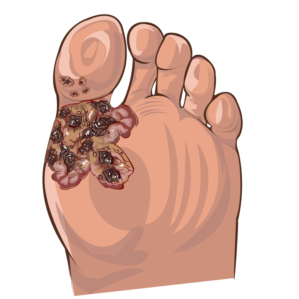 Illustration Design by vesna.radulovic1 for University of utah | Design: #21483914