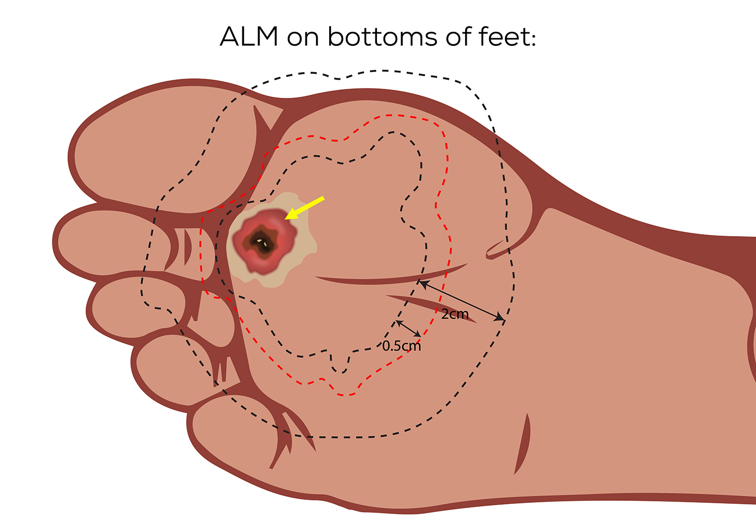 Diseño Con Ilustración por SAI DESIGNS para University of utah | Diseño #21490563