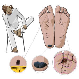 Illustration Design by julia.gnedina for University of utah | Design: #21452428