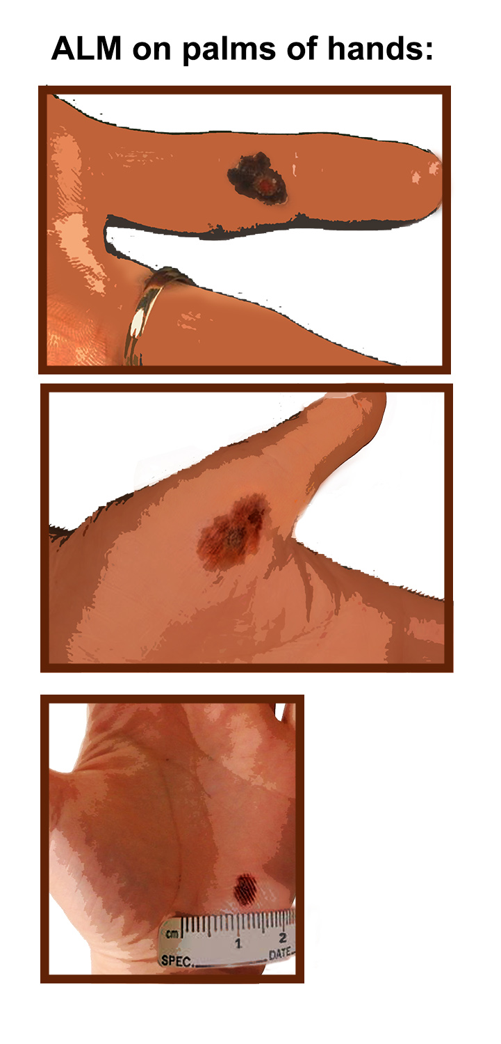 Illustration Design by Ann_RS - Anelia for University of utah | Design #21403245