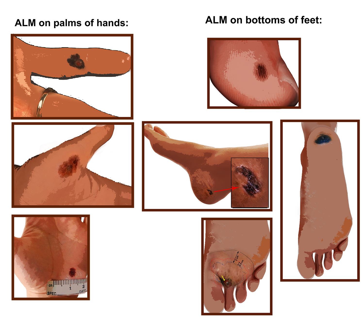 Illustration Design by Ann_RS - Anelia for University of utah | Design #21403797
