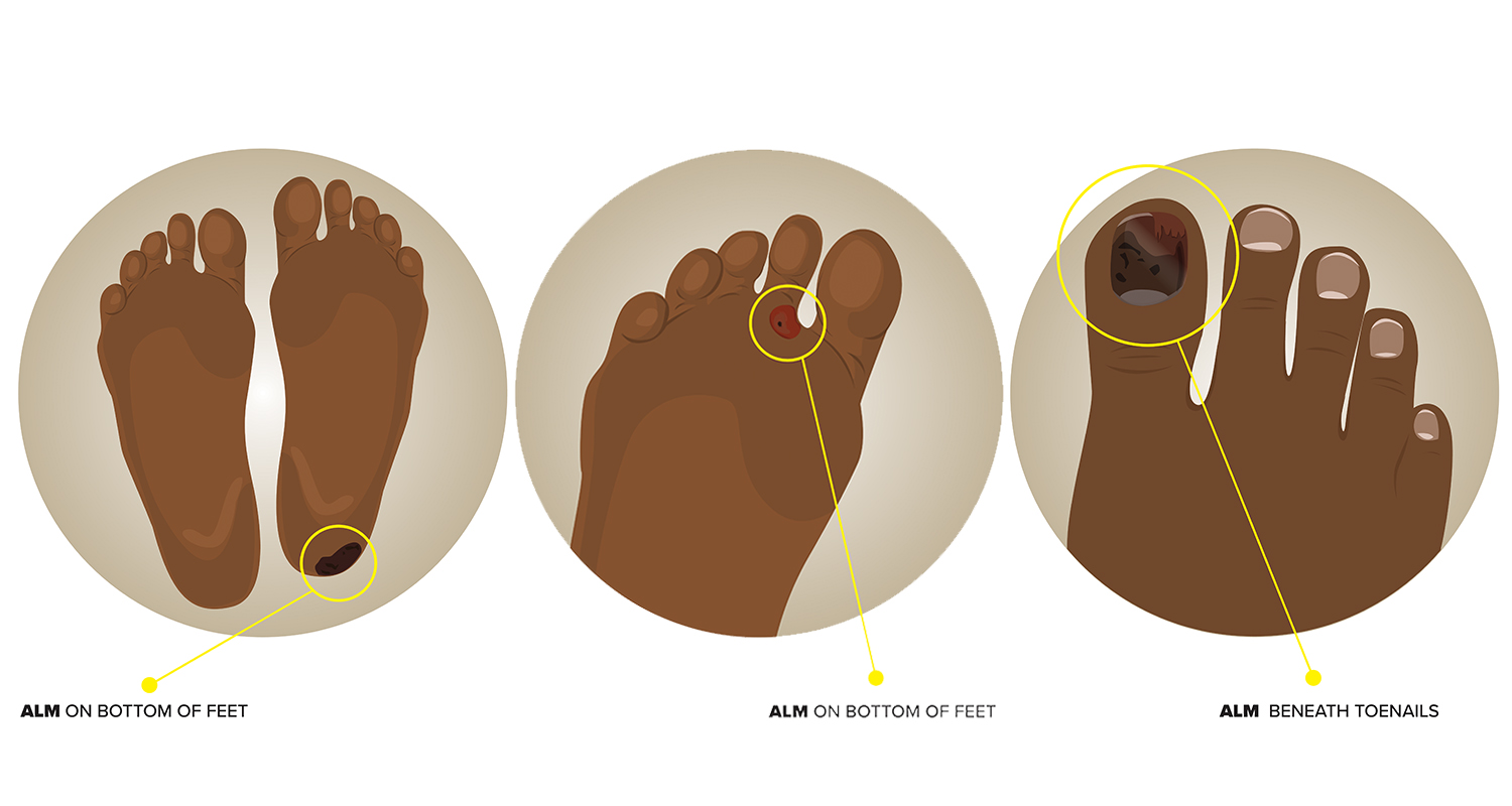 Illustration Design by EA5Designs for University of utah | Design #21447529