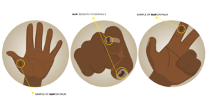 Cancer Researchers need illustrations to help people identify rare skin cancer | Illustration Design by EA5Designs