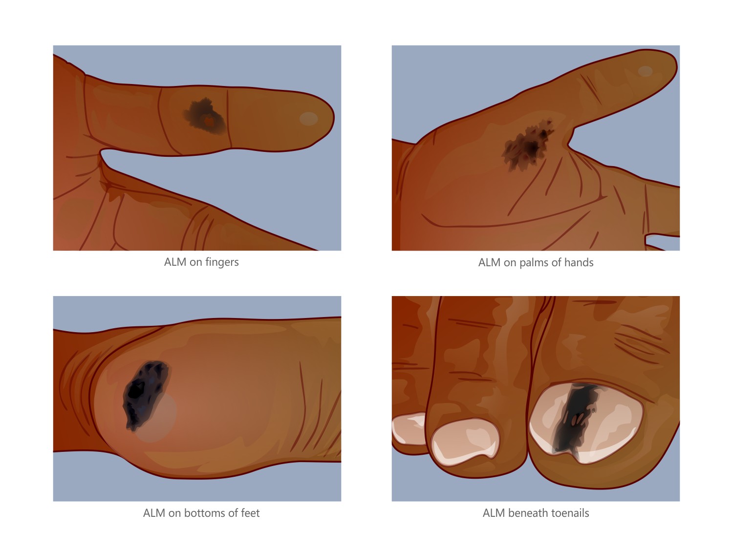 Illustration Design by bojboga for University of utah | Design #21475659