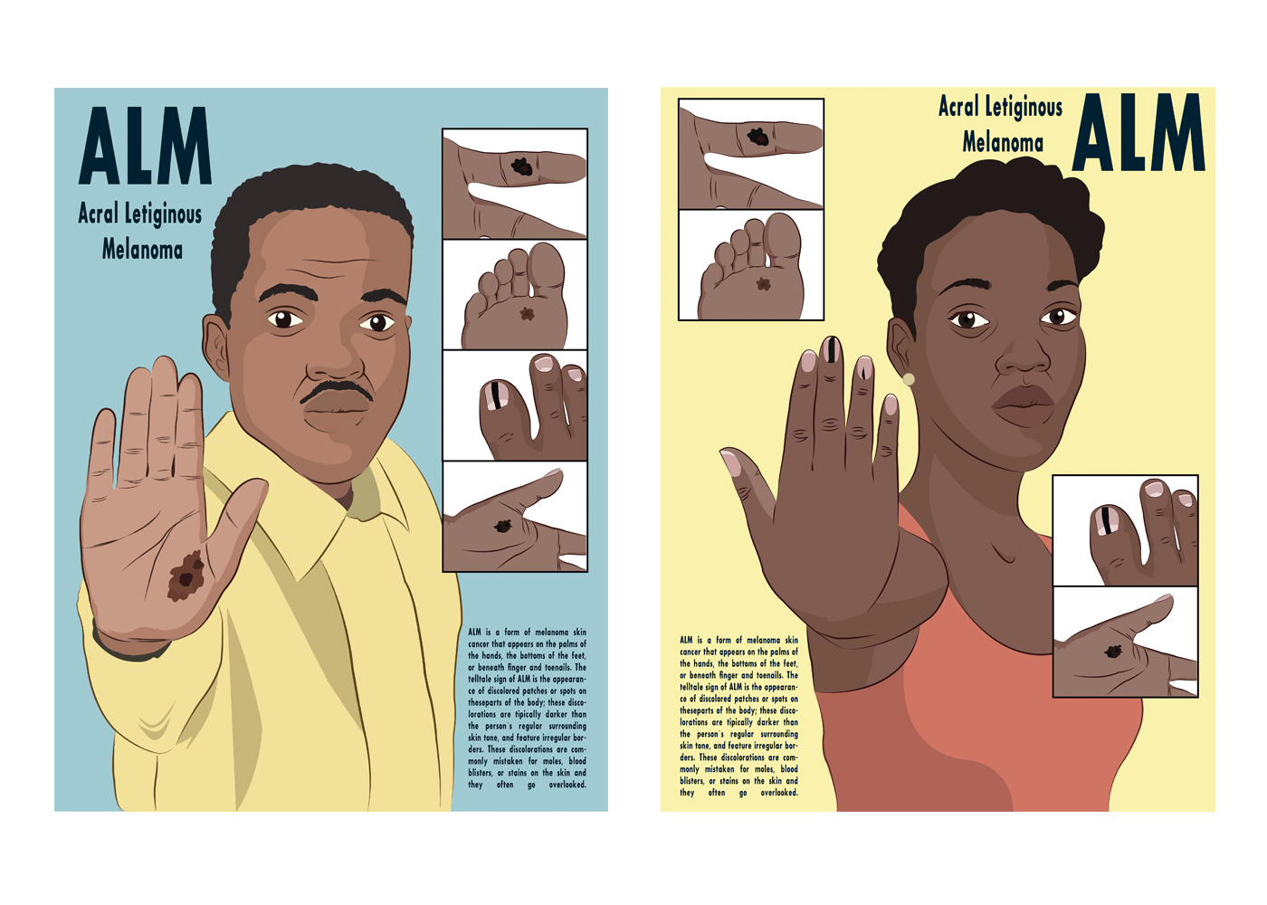 Illustration Design by YAS9 for University of utah | Design #21449503