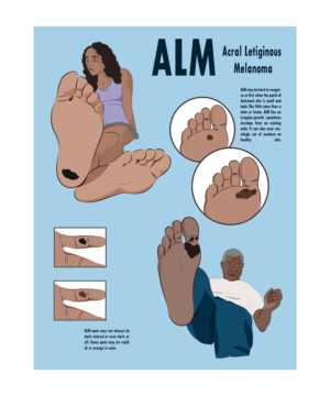 Illustration Design by YAS9 for University of utah | Design: #21460737