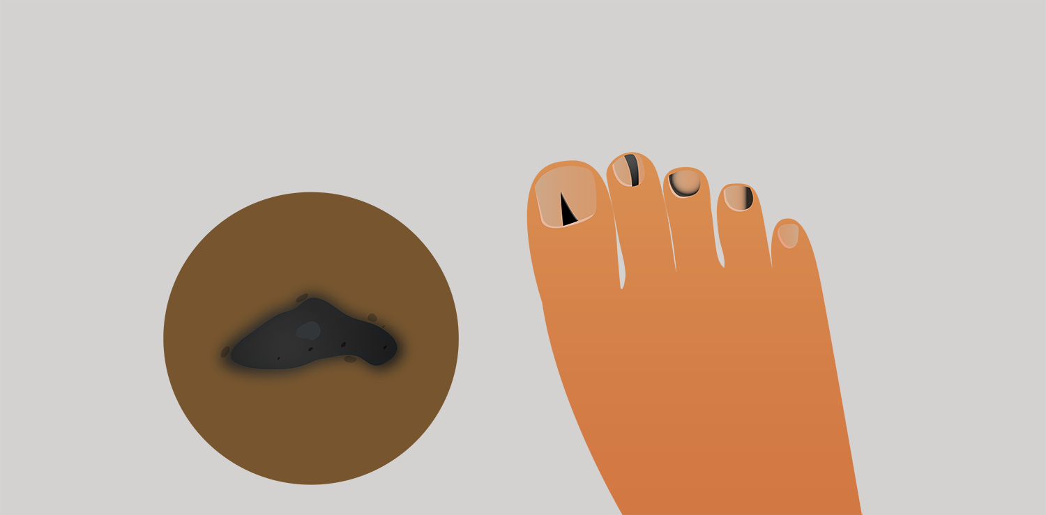 Illustration Design by IndreDesign for University of utah | Design #21431244