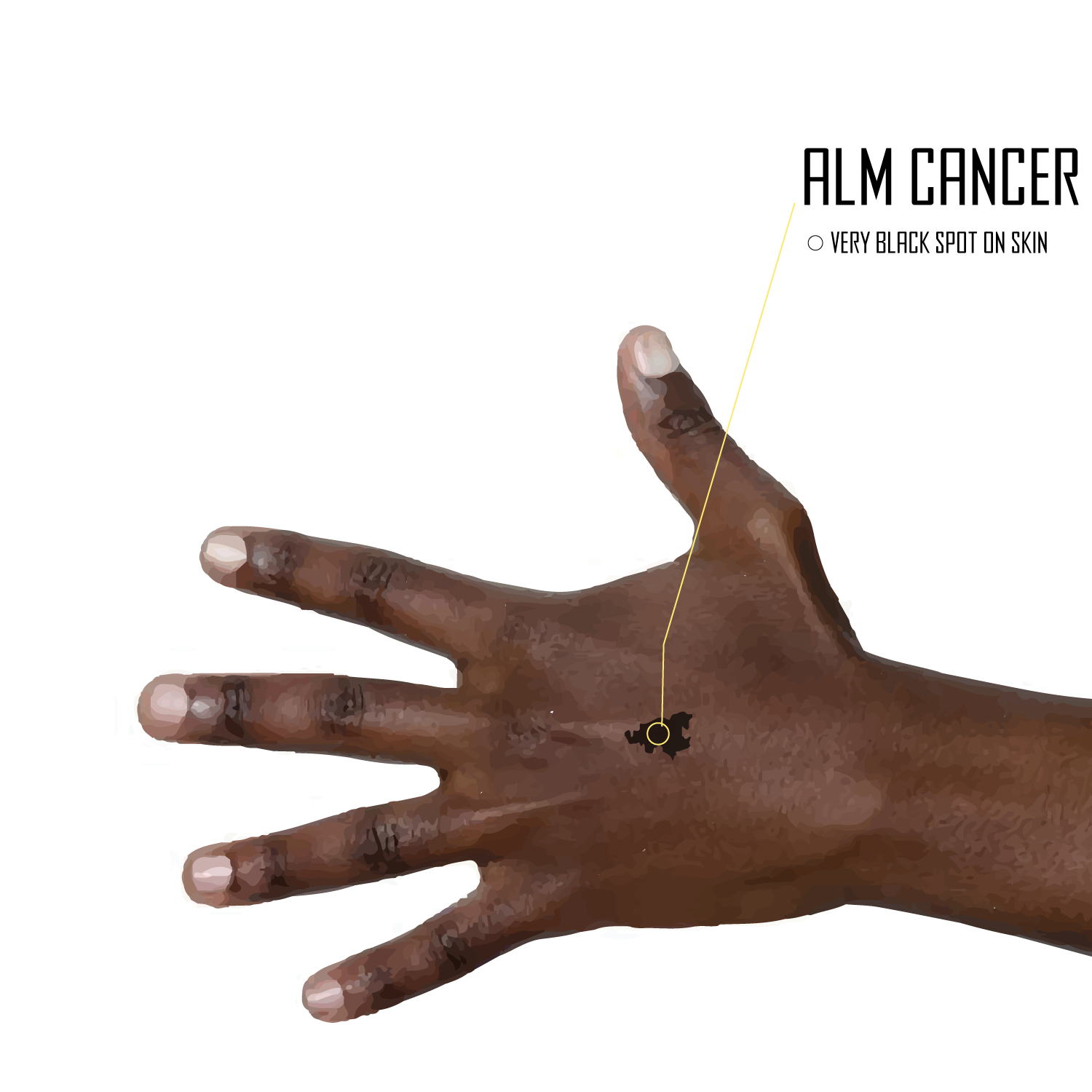 Illustration Design by MR.Designer 1 for University of utah | Design #21449102