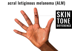 Illustration Design by MR.Designer 1 for University of utah | Design: #21466834