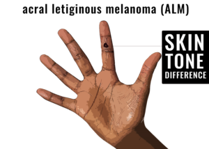 Illustration Design by MR.Designer 1 for University of utah | Design: #21473302