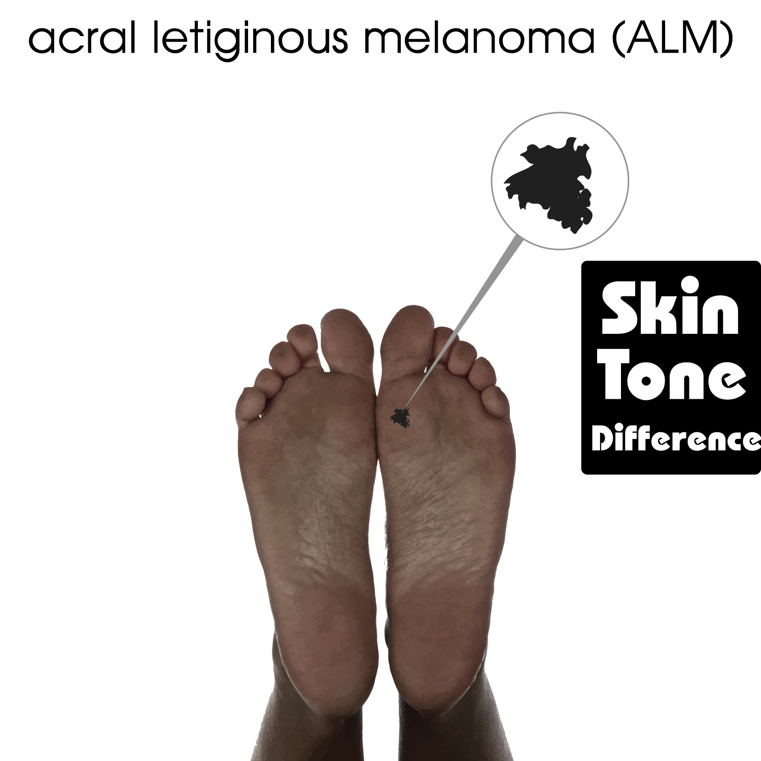 Illustration Design by MR.Designer 1 for University of utah | Design #21474914