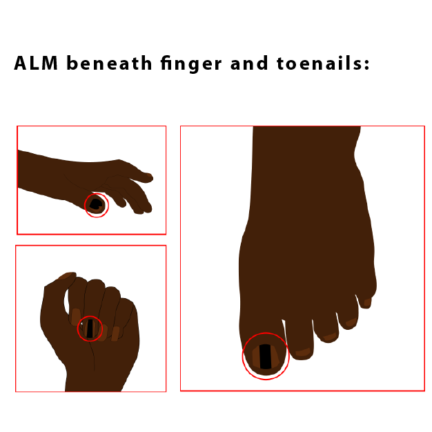 Illustration Design by Melvina_West for University of utah | Design #21441699