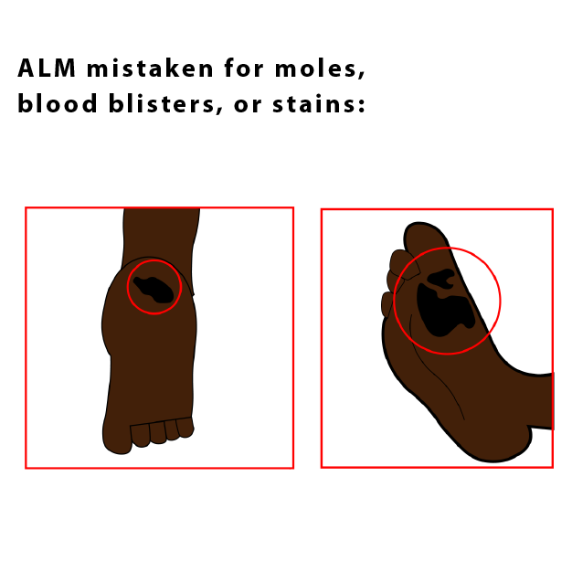 Illustration Design by Melvina_West for University of utah | Design #21441710