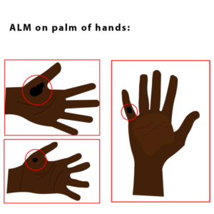 Illustration Design by Melvina_West for University of utah | Design: #21459333