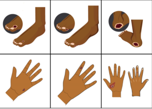 Illustration Design by pd graphic 2 for University of utah | Design: #21415551