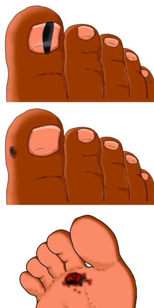 Illustration Design by Luca-Mendieta for University of utah | Design: #21422592