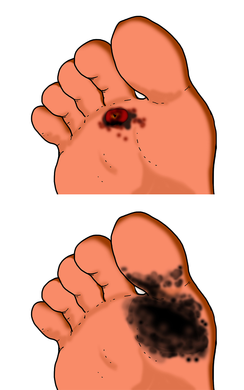 Illustration Design by Luca-Mendieta for University of utah | Design #21422593