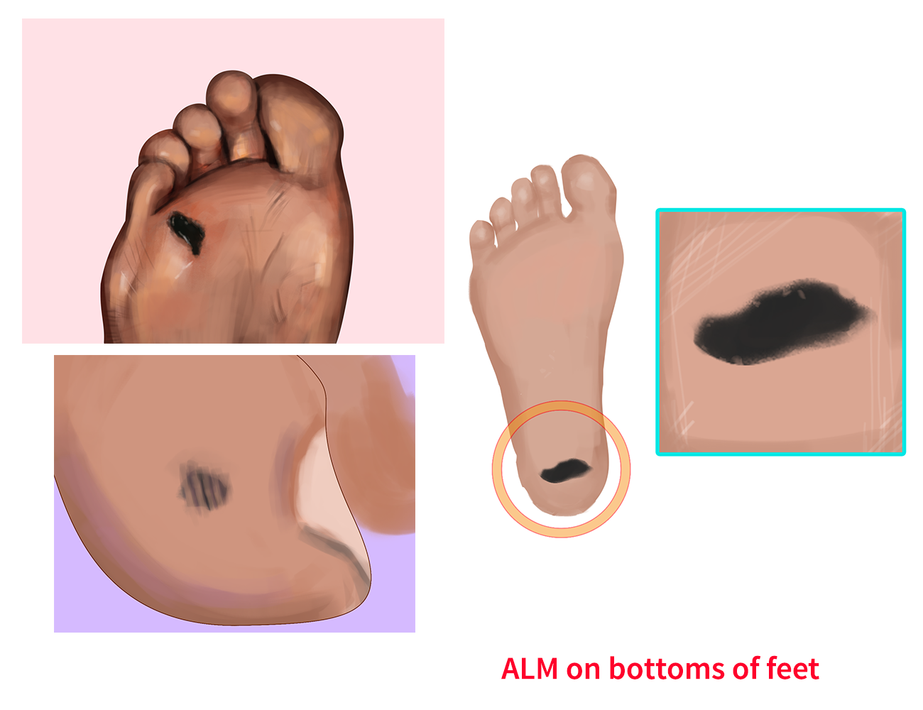 Illustration Design by JMdeca for University of utah | Design #21449483