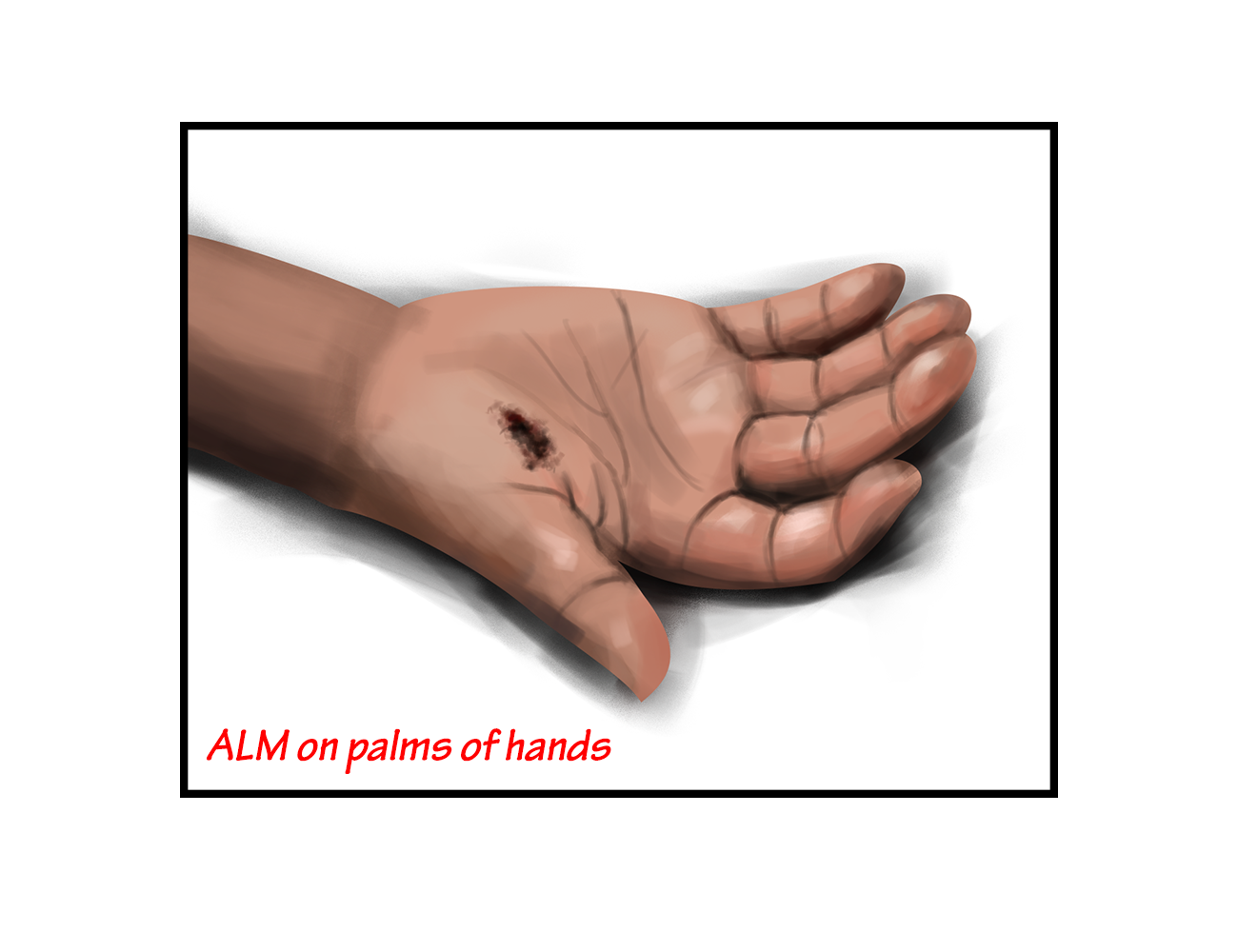 Illustration Design by JMdeca for University of utah | Design #21449485