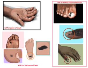 Illustration Design by JMdeca for University of utah | Design: #21449486