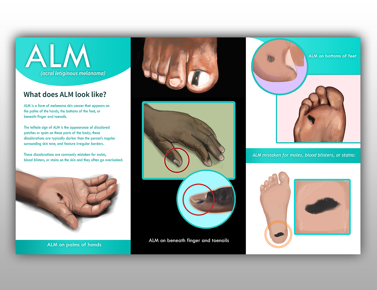 Illustration Design by JMdeca for University of utah | Design #21483211