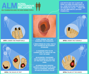 Illustration Design by Manvendra Singh 3 for University of utah | Design: #21453000