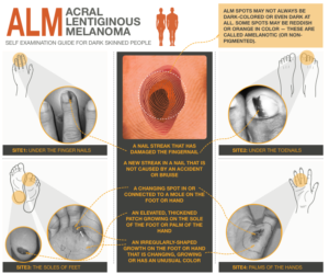 Illustration Design by Manvendra Singh 3 for University of utah | Design: #21453004