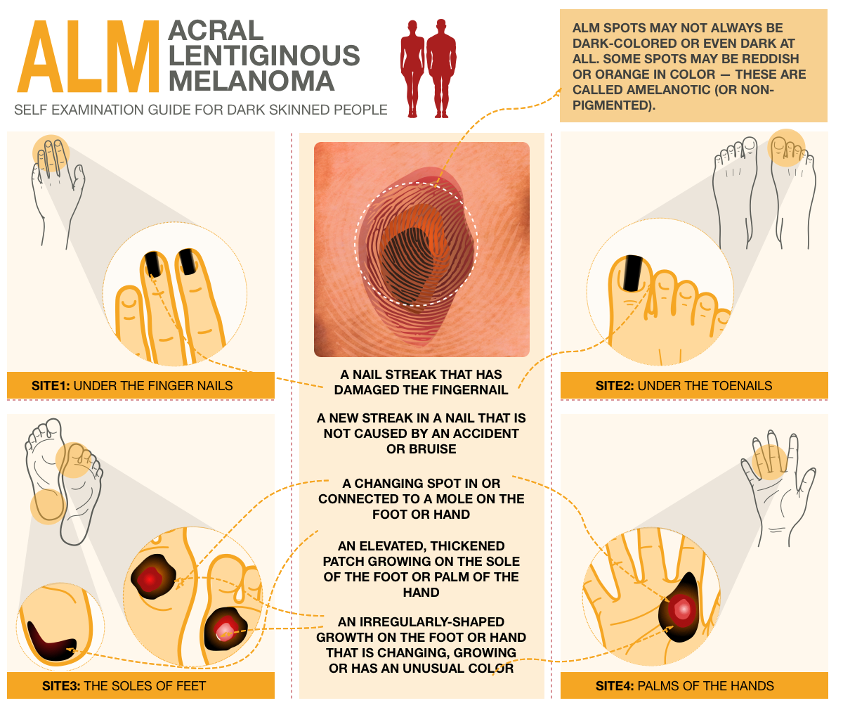 Diseño Con Ilustración por Manvendra Singh 3 para University of utah | Diseño #21453005