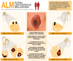 Illustration Design by Manvendra Singh 3 for University of utah | Design: #21453005