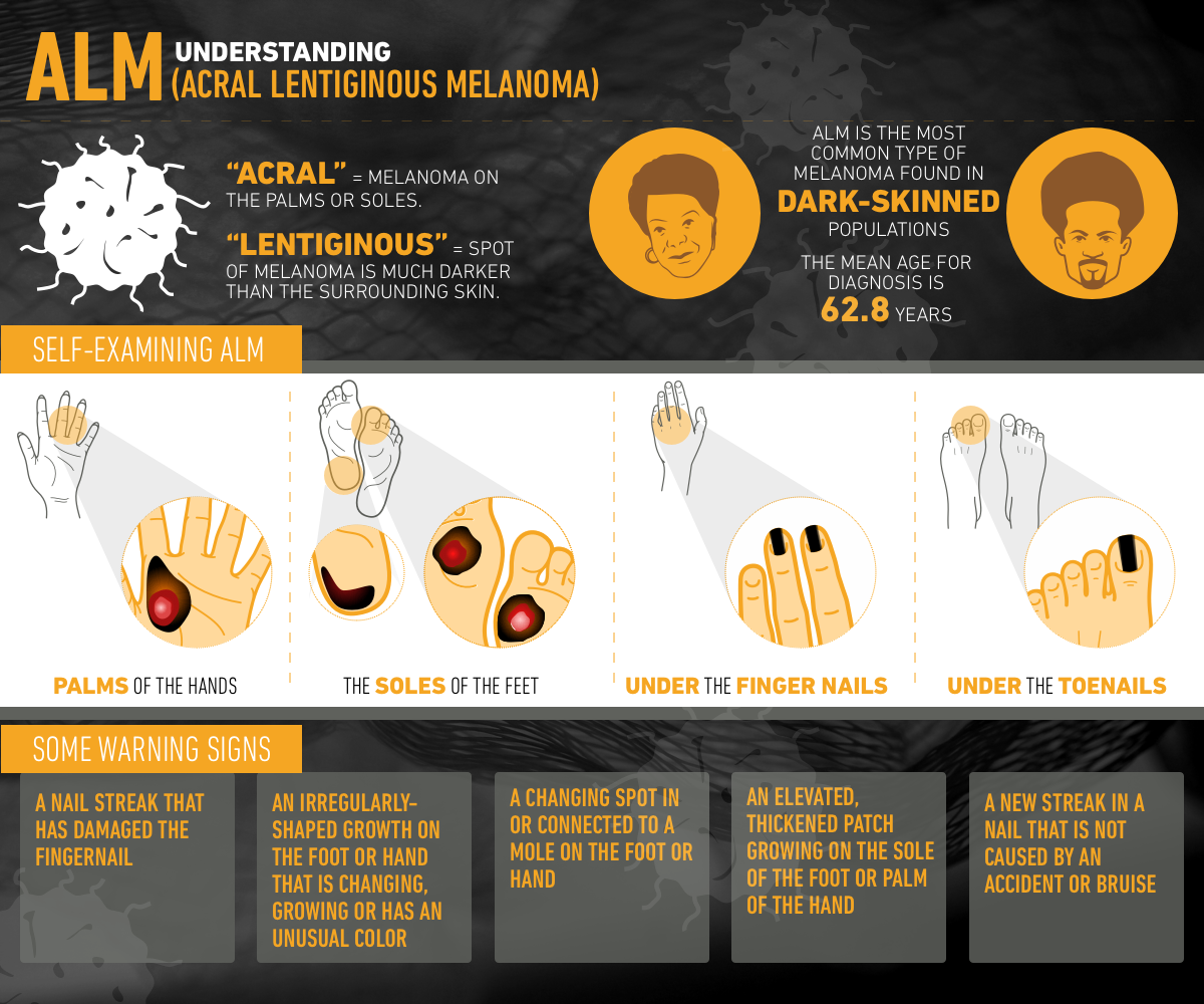 Diseño Con Ilustración por Manvendra Singh 3 para University of utah | Diseño #21453018