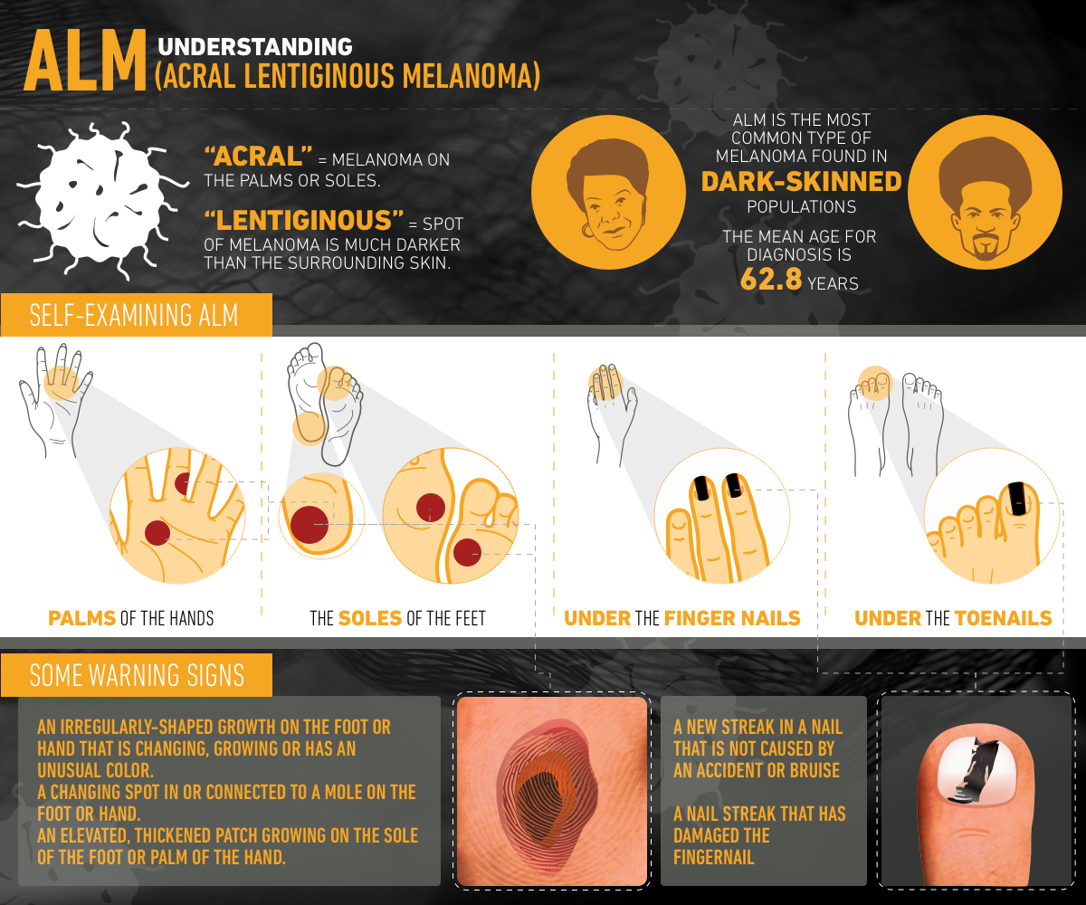 Illustration Design by Manvendra Singh 3 for University of utah | Design #21497472