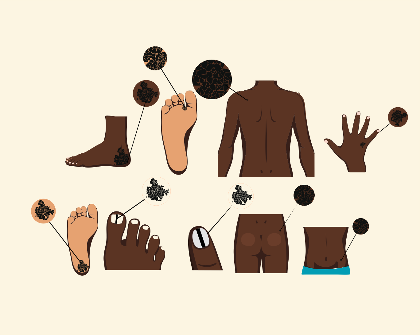 Illustration Design by D/Art for University of utah | Design #21453959