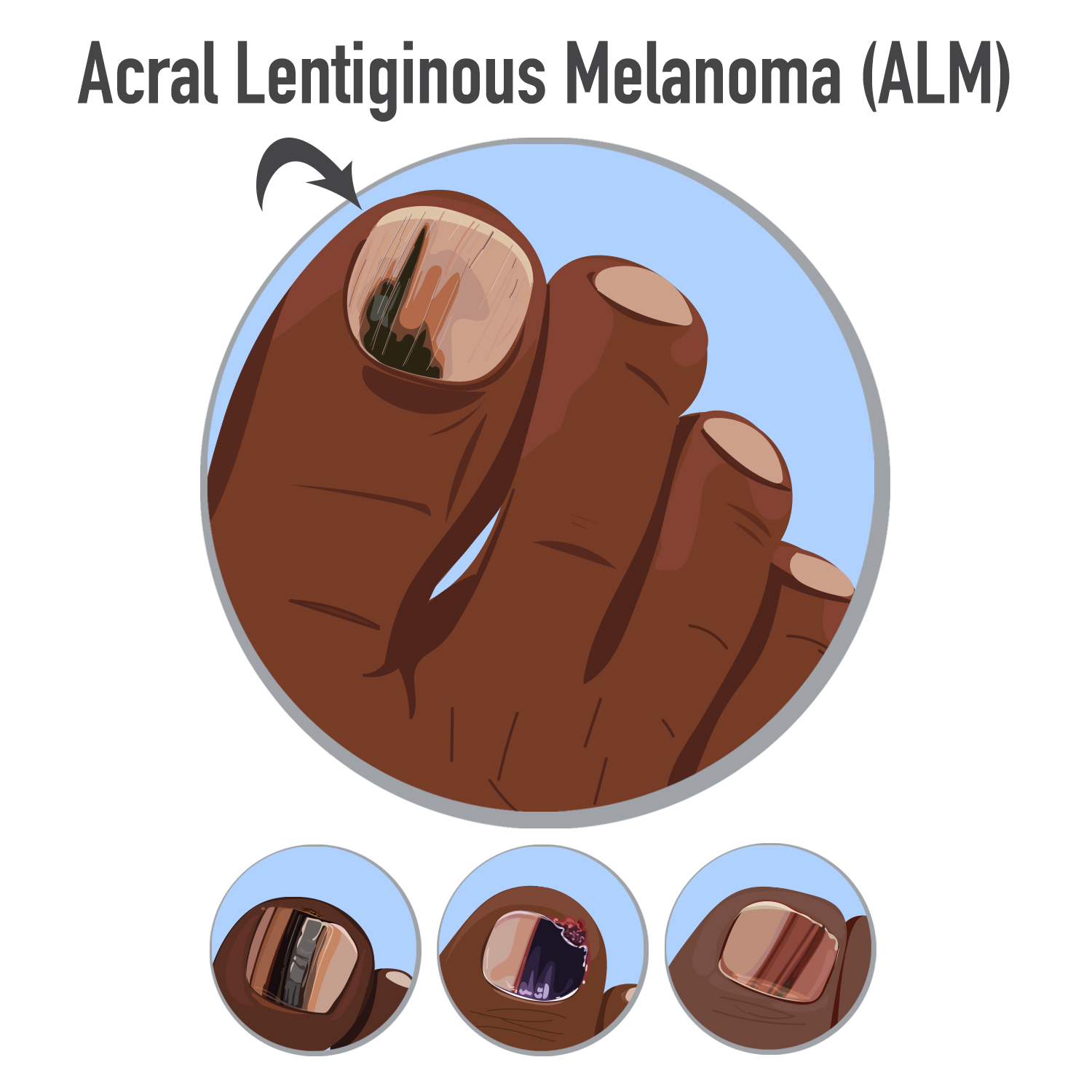 Diseño Con Ilustración por Wiihee para University of utah | Diseño #21488293