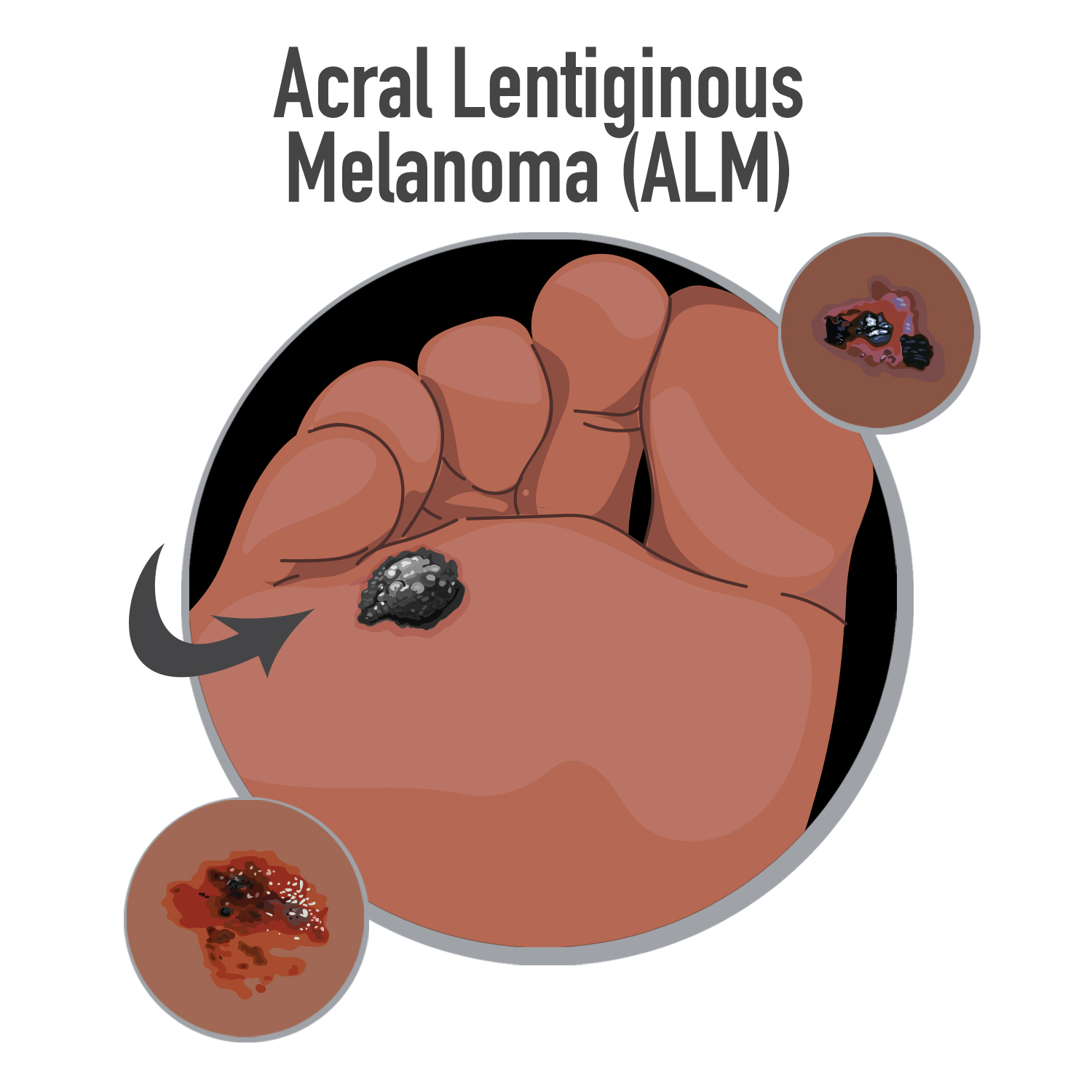 Diseño Con Ilustración por Wiihee para University of utah | Diseño #21493212