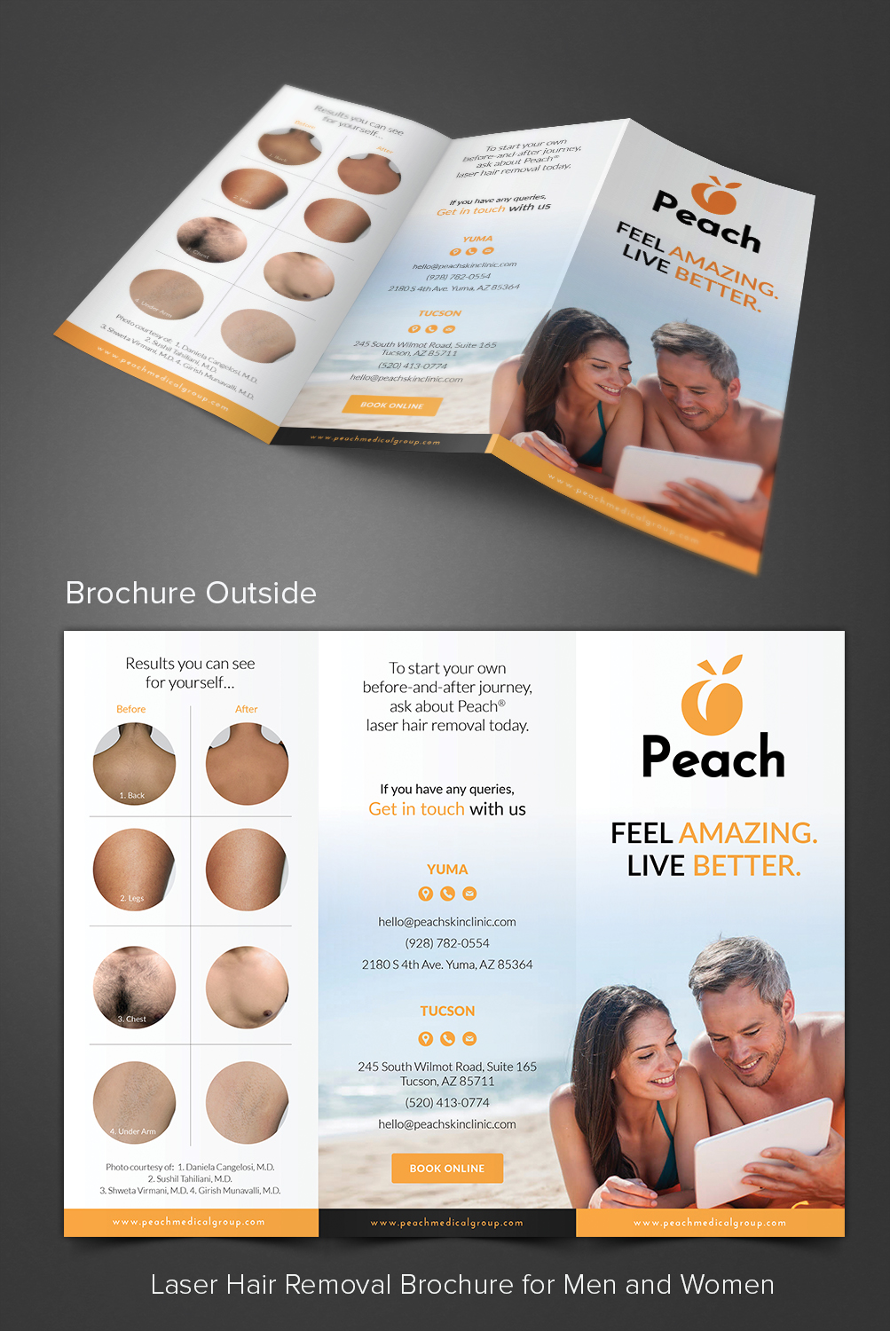 Flyer Design by ARTOGRAPHY for Peach Skin & Laser | Design #21975591