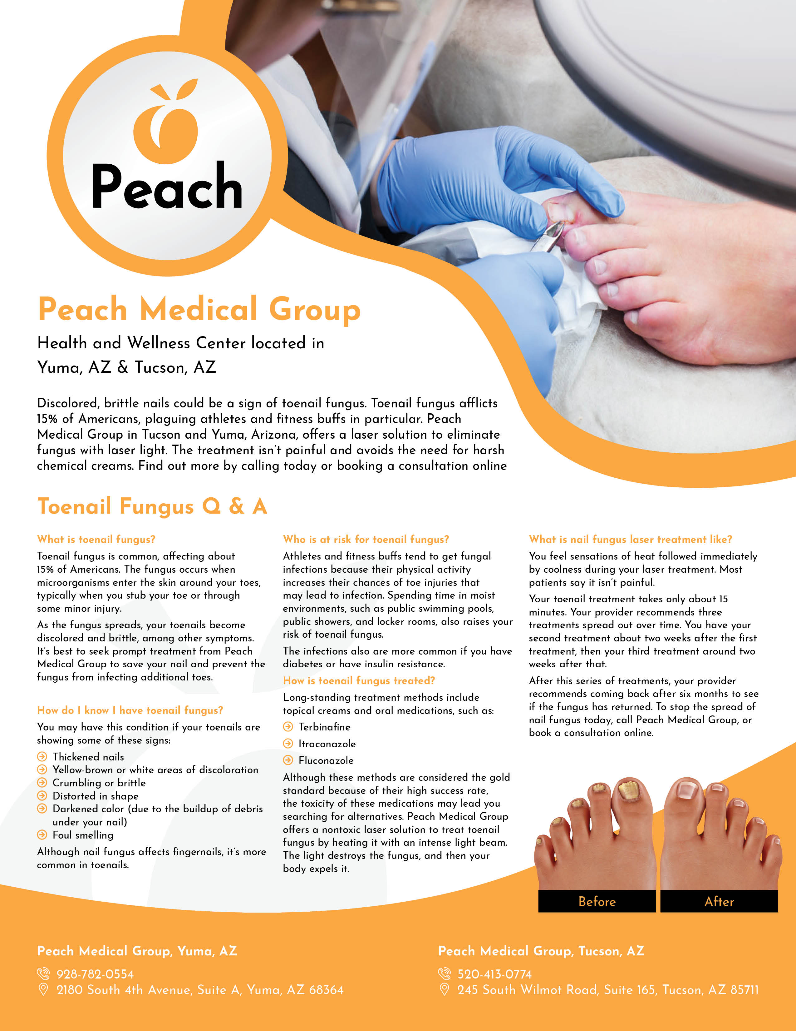 Flyer Design by enamalraj for Peach Skin & Laser | Design #22039046
