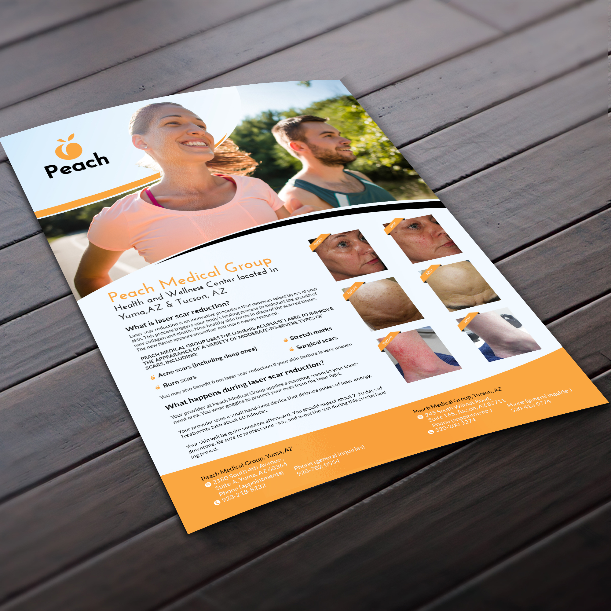 Flyer Design by debdesign for Peach Skin & Laser | Design #22099597