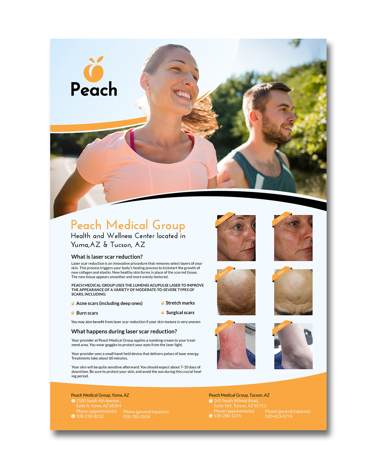 Flyer Design by debdesign for Peach Skin & Laser | Design #22099635