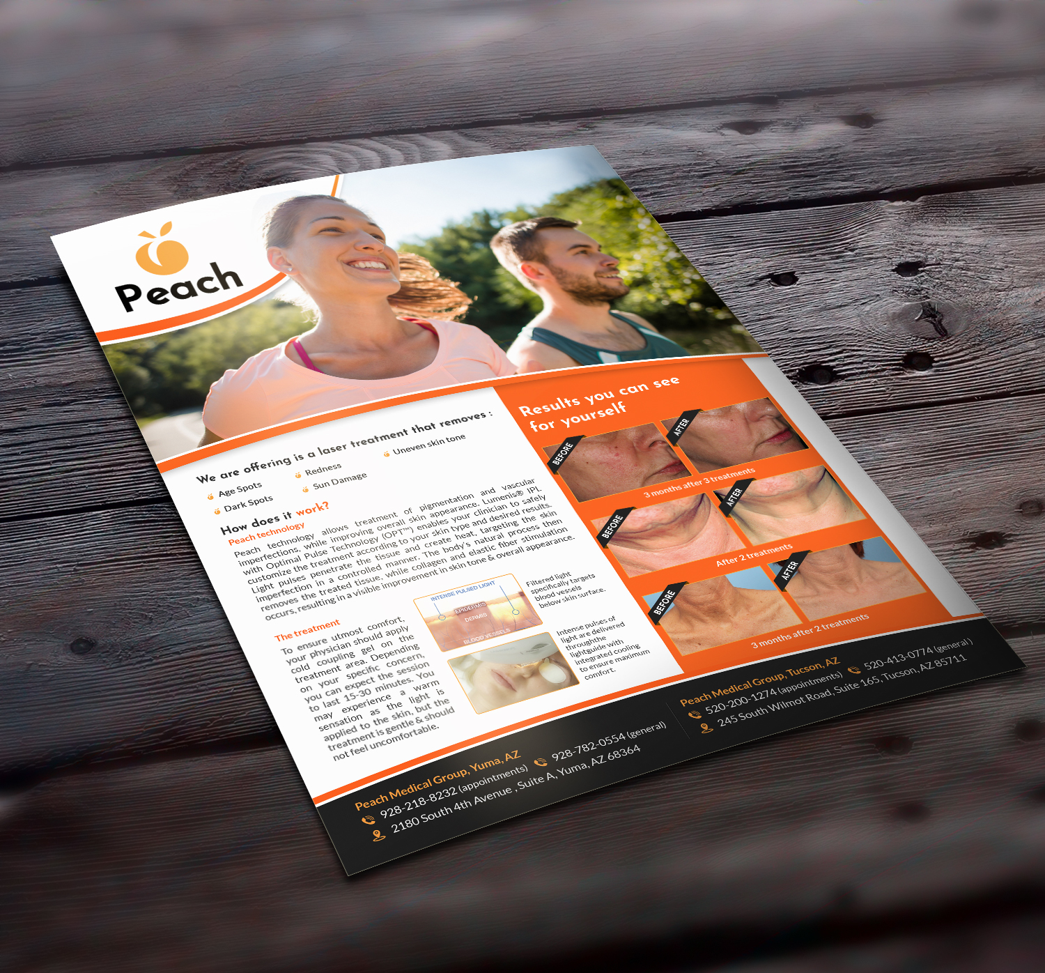 Design de Flyer par GraphicsGuru pour Peach Skin & Laser | Design #22095468