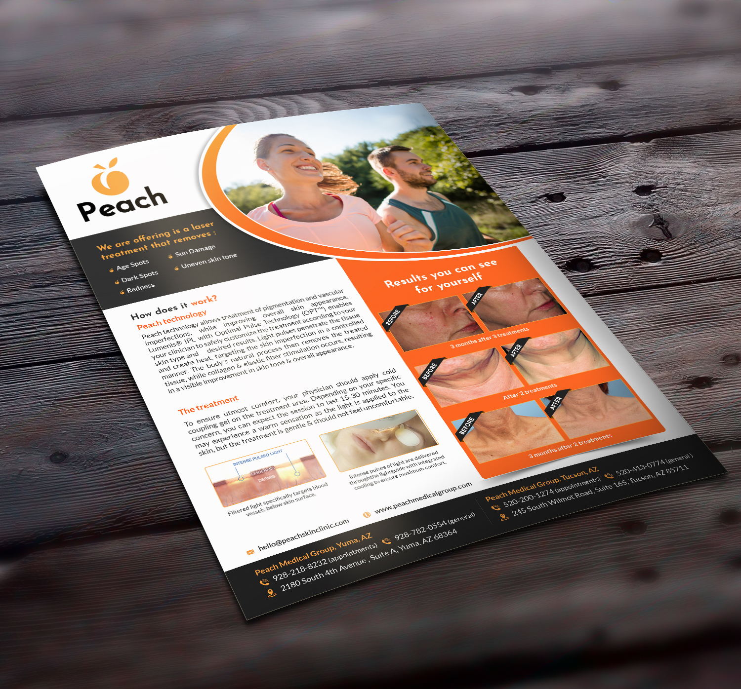 Diseño de Flyer por GraphicsGuru para Peach Skin & Laser | Diseño #22095564