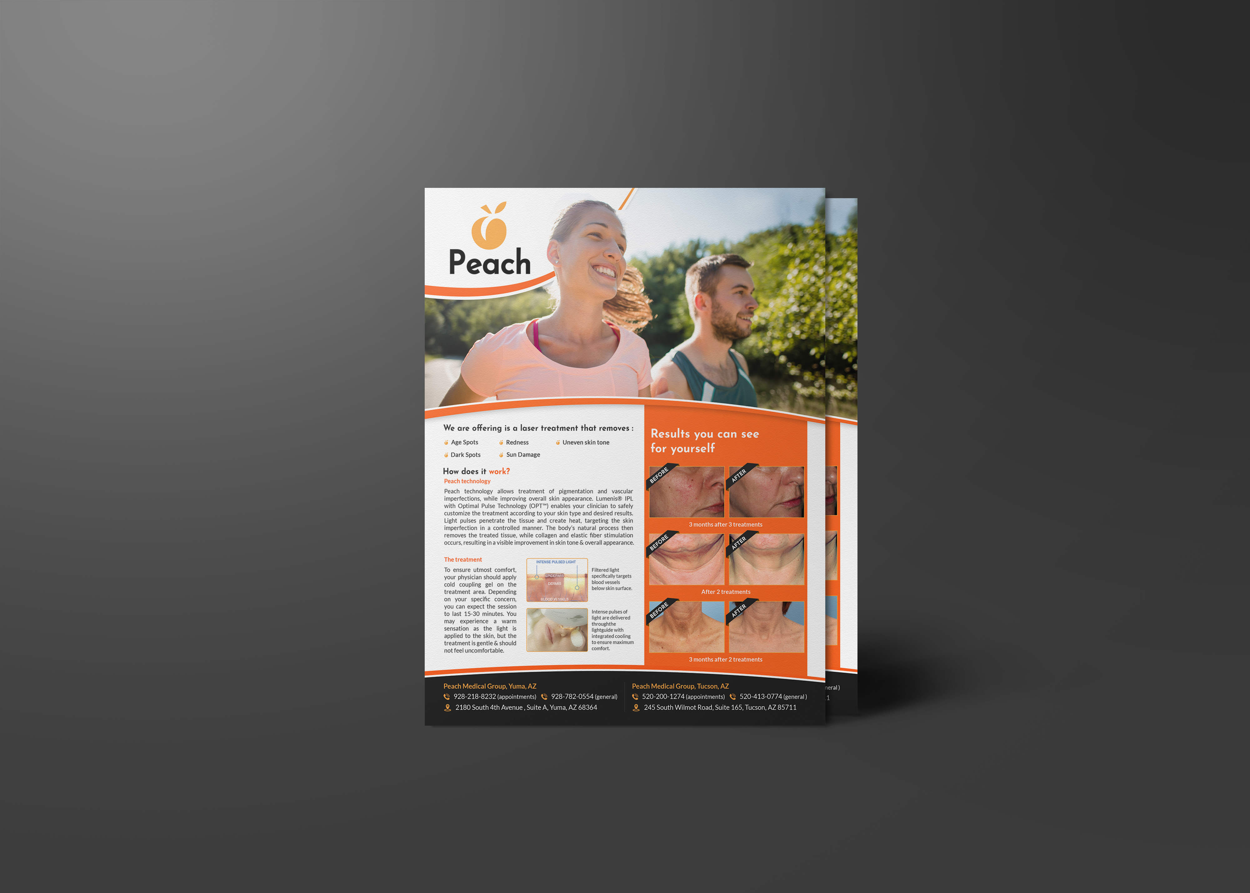 Design de Flyer par GraphicsGuru pour Peach Skin & Laser | Design #22097778