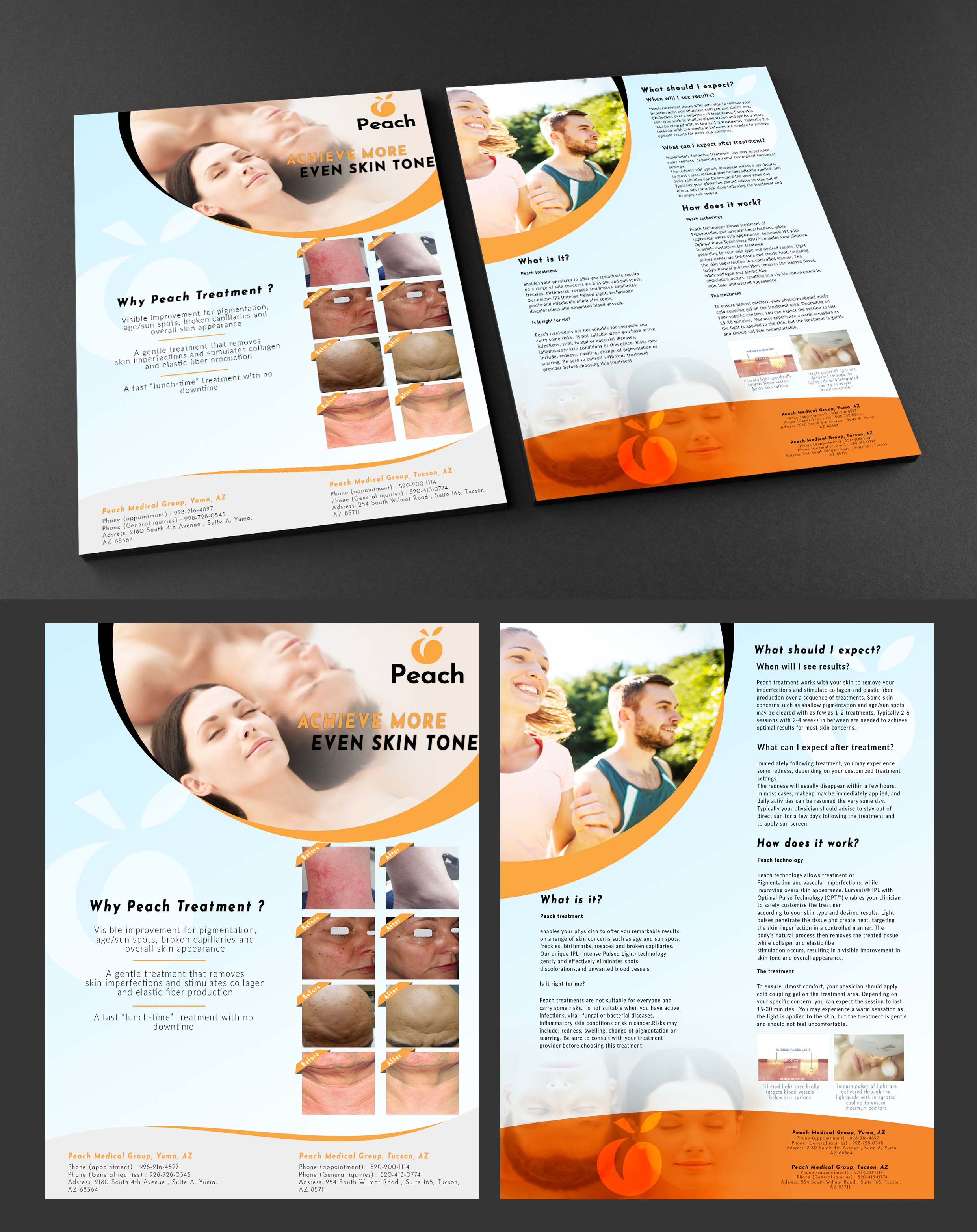 Flyer Design by Adnan.design for Peach Skin & Laser | Design #22095726
