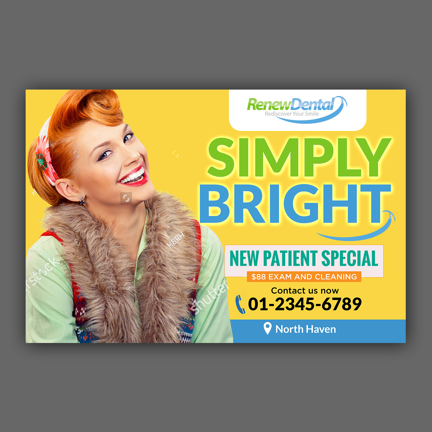 Newspaper Ad Design by aspiremedia for Renew Dental | Design #22697195