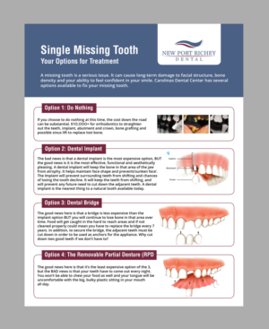 Dental office needs a handout for missing tooth options | Flyer-Design von AbyJohns