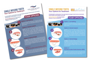 Dental office needs a handout for missing tooth options | Flyer-Design von TracyInspires